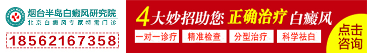 烟台半岛白癜风研究院